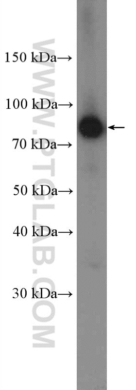 WB analysis of mouse brain using 14364-1-AP