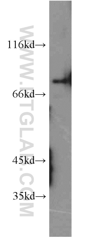 Western Blot (WB) analysis of human brain tissue using PKC Gamma Polyclonal antibody (14364-1-AP)