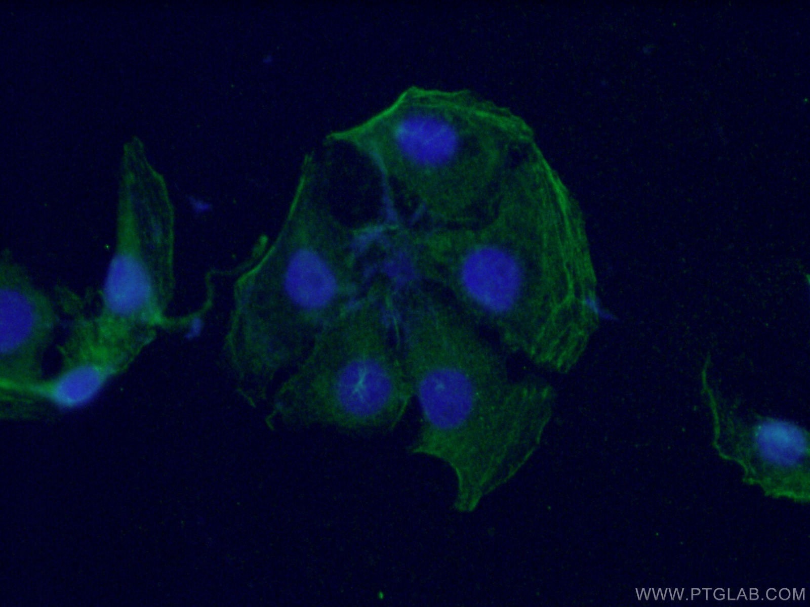Immunofluorescence (IF) / fluorescent staining of SH-SY5Y cells using PKC Gamma Monoclonal antibody (66429-1-Ig)
