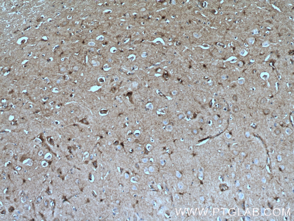 Immunohistochemistry (IHC) staining of human brain tissue using PKC Gamma Monoclonal antibody (66429-1-Ig)