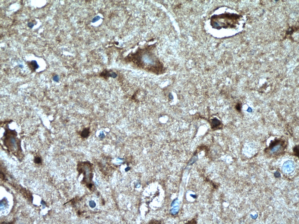 Immunohistochemistry (IHC) staining of human brain tissue using PKC Gamma Monoclonal antibody (66429-1-Ig)
