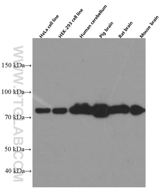 Western Blot (WB) analysis of various lysates using PKC Gamma Monoclonal antibody (66429-1-Ig)
