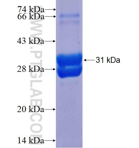 PRKCG fusion protein Ag25085 SDS-PAGE