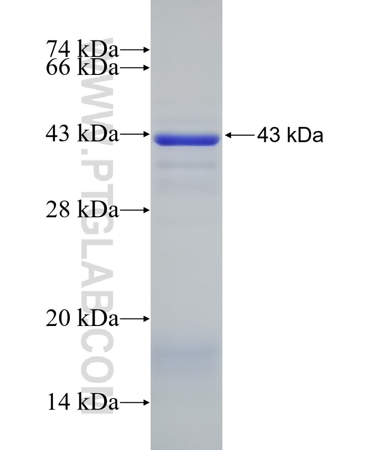 PRKCG fusion protein Ag5910 SDS-PAGE
