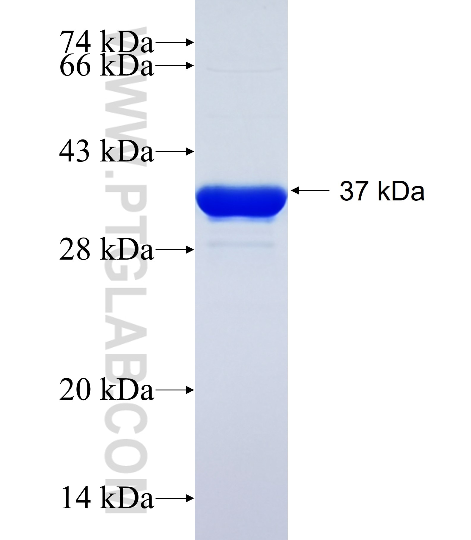 PRKCH fusion protein Ag25365 SDS-PAGE