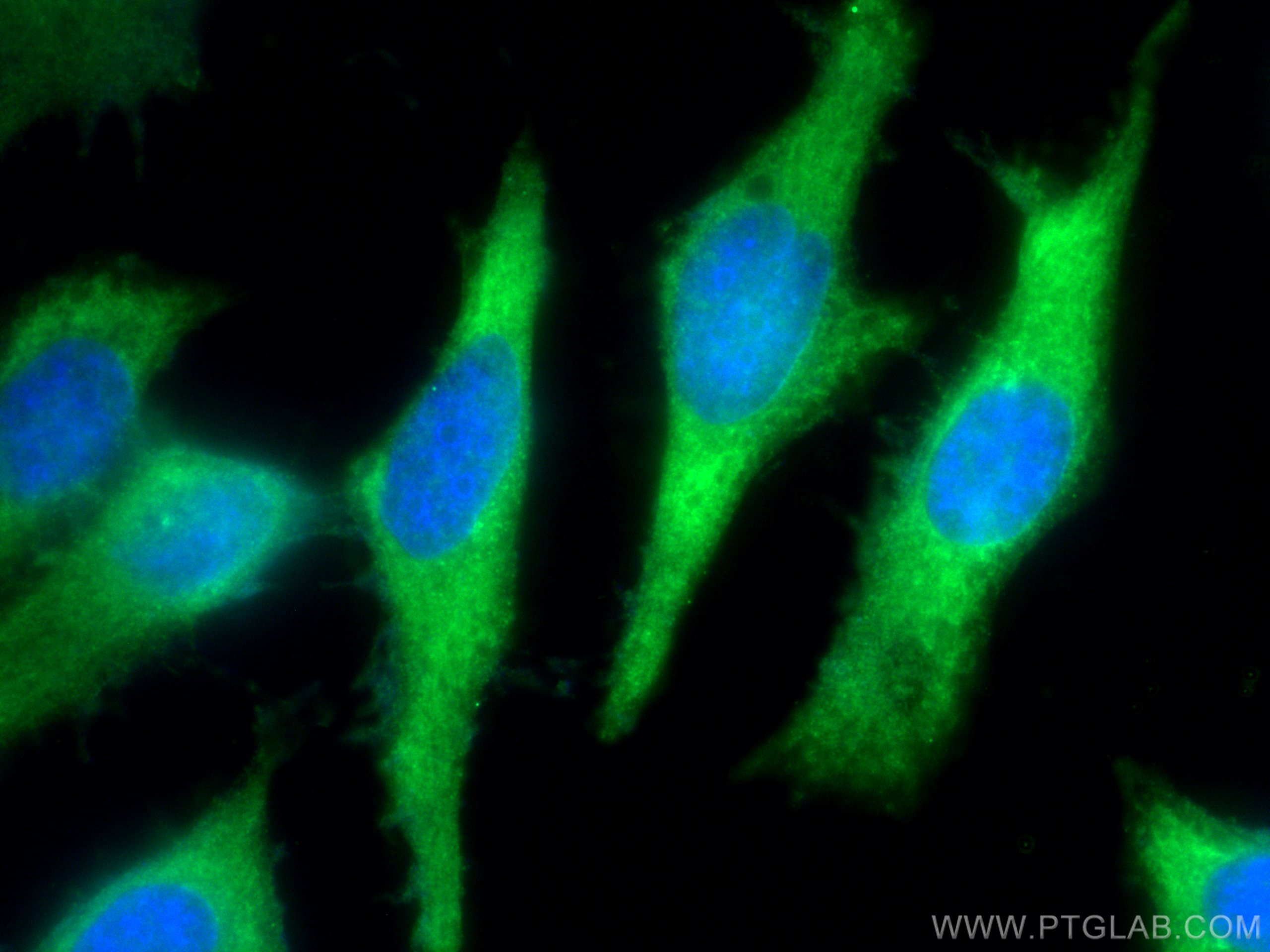 Immunofluorescence (IF) / fluorescent staining of HeLa cells using PKC Iota Polyclonal antibody (13883-1-AP)