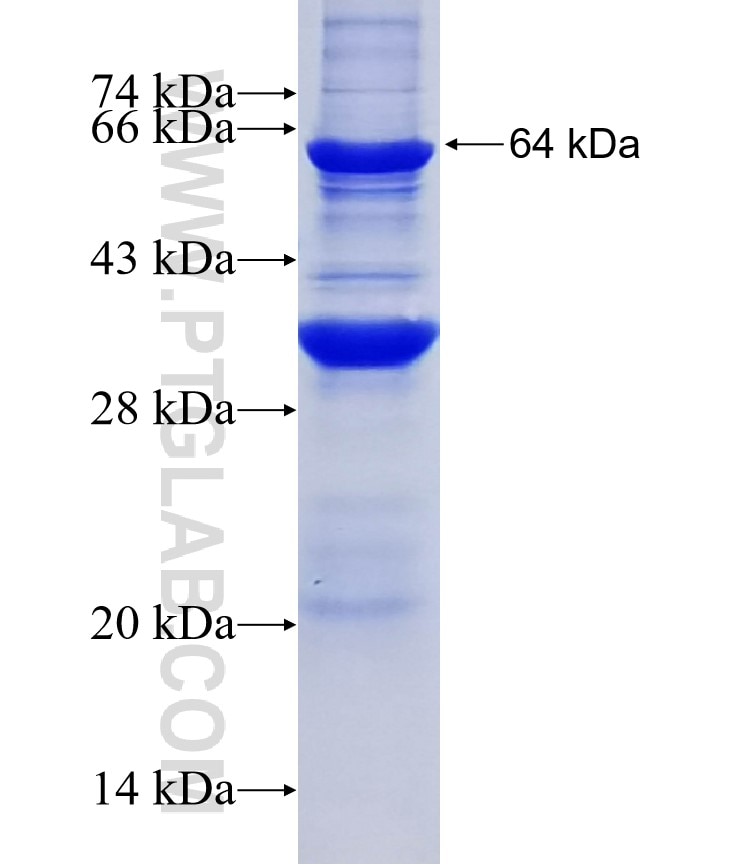 PRKCI fusion protein Ag4990 SDS-PAGE