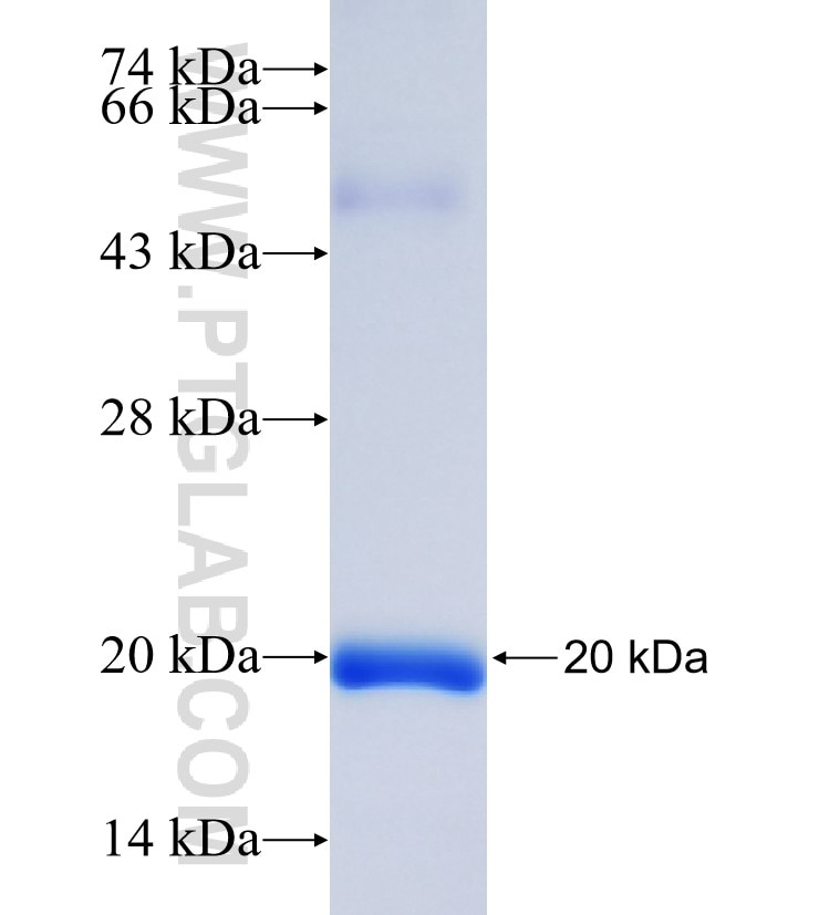 PRKCQ fusion protein Ag26331 SDS-PAGE