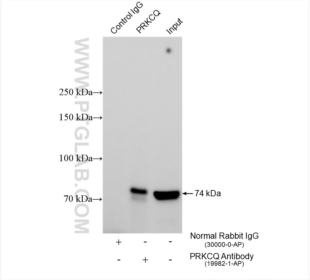 Immunoprecipitation (IP) experiment of K-562 cells using PRKCQ-Specific Polyclonal antibody (19982-1-AP)