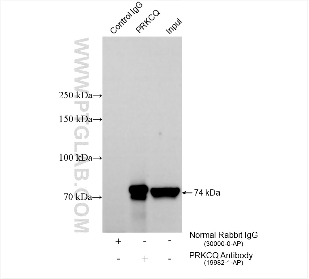 Immunoprecipitation (IP) experiment of Jurkat cells using PRKCQ-Specific Polyclonal antibody (19982-1-AP)