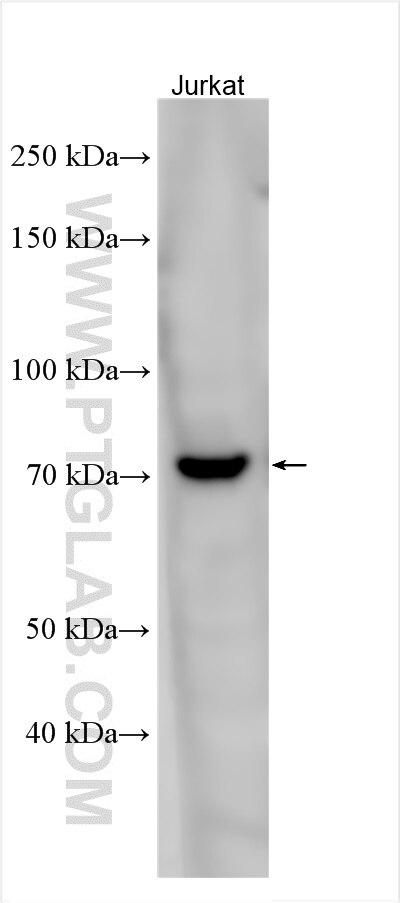 Western Blot (WB) analysis of various lysates using PRKCQ-Specific Polyclonal antibody (19982-1-AP)