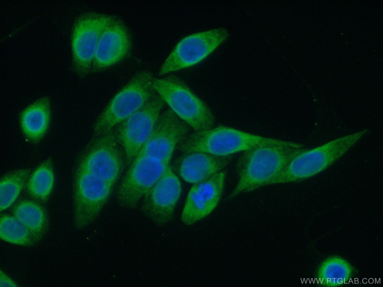 Immunofluorescence (IF) / fluorescent staining of HeLa cells using PRKCSH Polyclonal antibody (12148-1-AP)