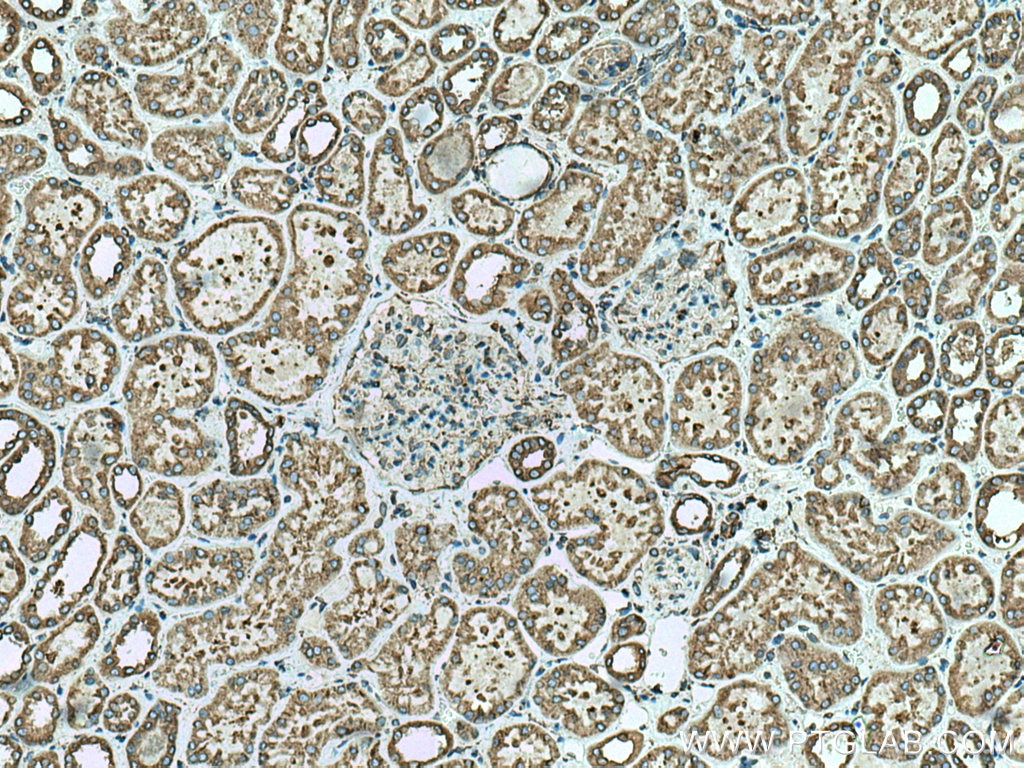 Immunohistochemistry (IHC) staining of human kidney tissue using PRKCSH Polyclonal antibody (12148-1-AP)