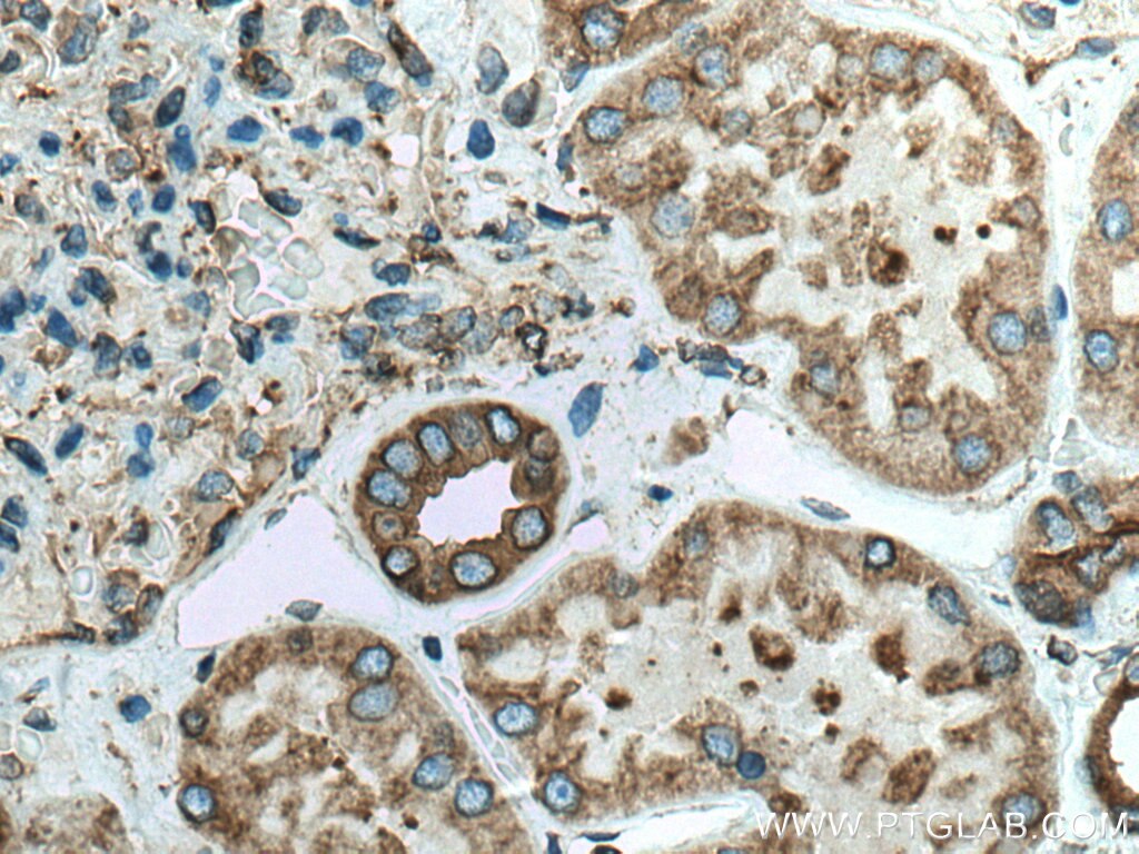 Immunohistochemistry (IHC) staining of human kidney tissue using PRKCSH Polyclonal antibody (12148-1-AP)