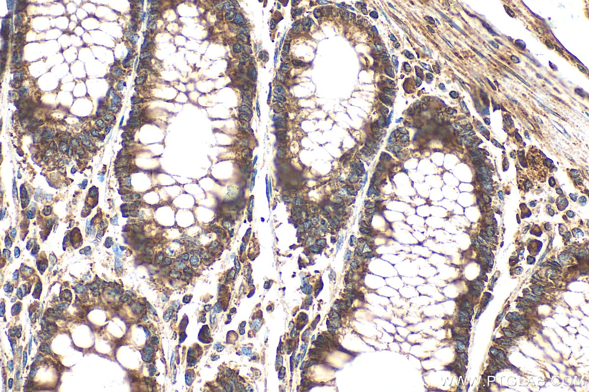 Immunohistochemistry (IHC) staining of human colon tissue using PRKCSH Polyclonal antibody (12148-1-AP)