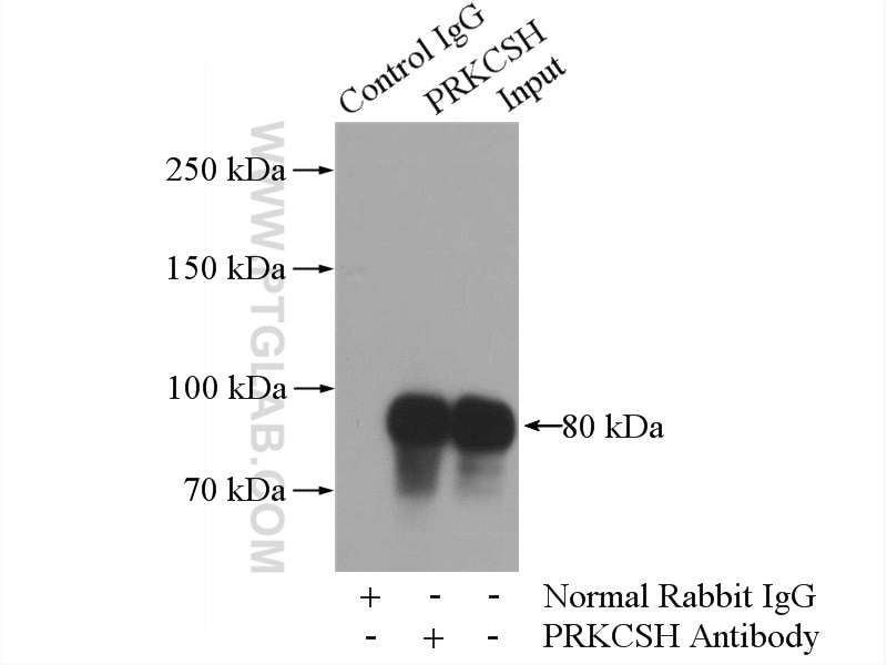 Immunoprecipitation (IP) experiment of HeLa cells using PRKCSH Polyclonal antibody (12148-1-AP)