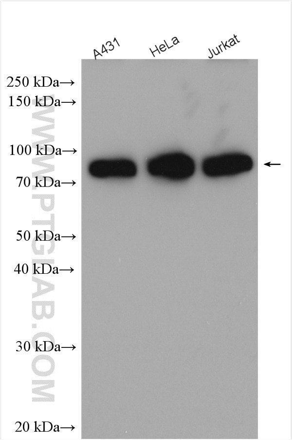 Western Blot (WB) analysis of various lysates using PRKCSH Polyclonal antibody (12148-1-AP)