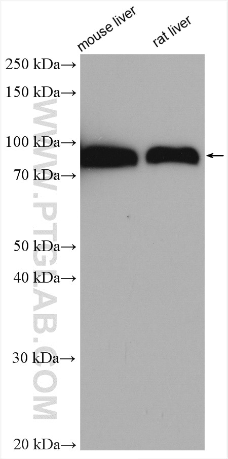 Western Blot (WB) analysis of various lysates using PRKCSH Polyclonal antibody (12148-1-AP)