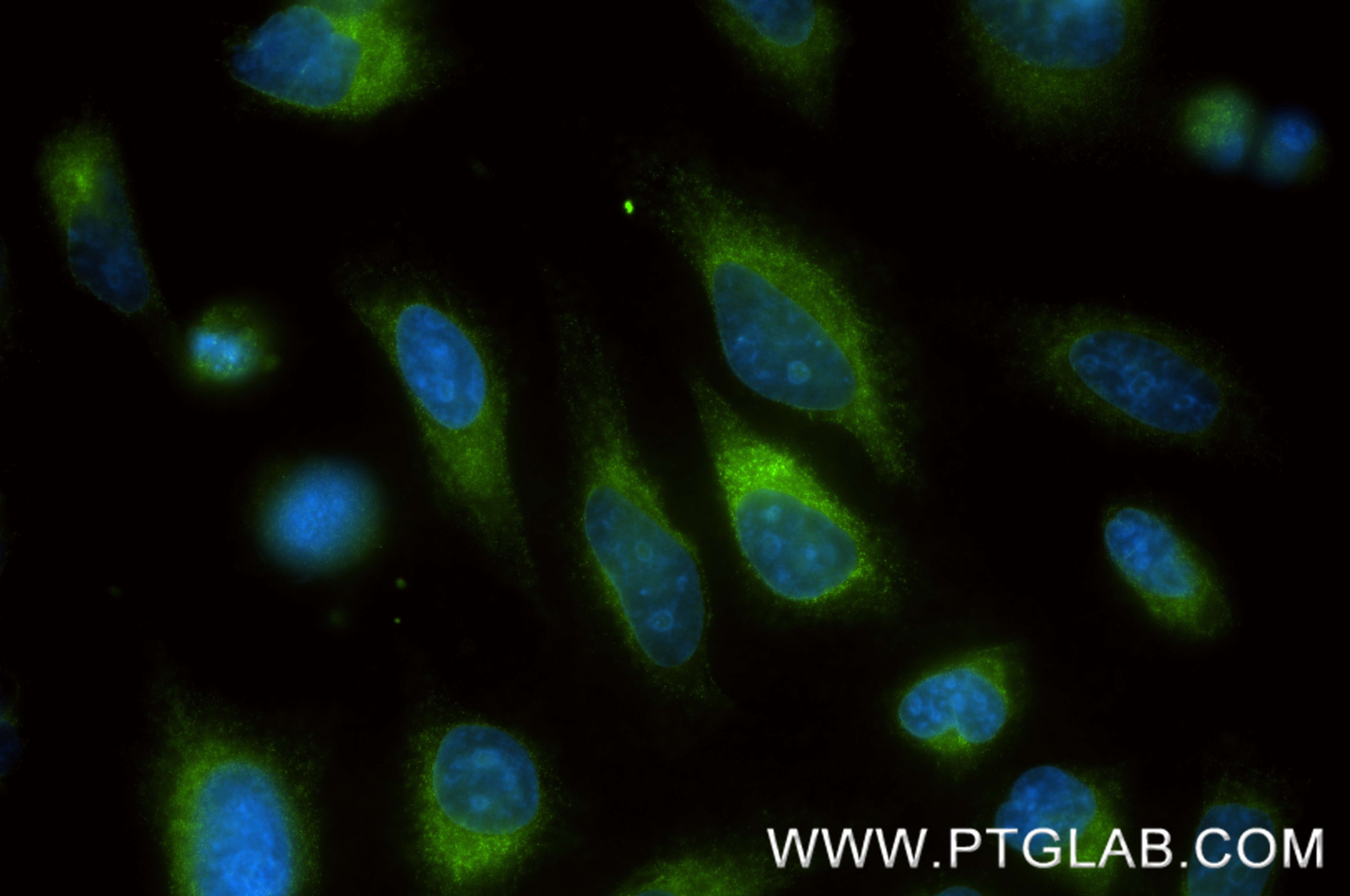IF Staining of HeLa using 87004-3-RR (same clone as 87004-3-PBS) Immunofluorescence (IF) / fluorescent staining of HeLa cells using PRKCSH Recombinant monoclonal antibody (87004-3-RR)