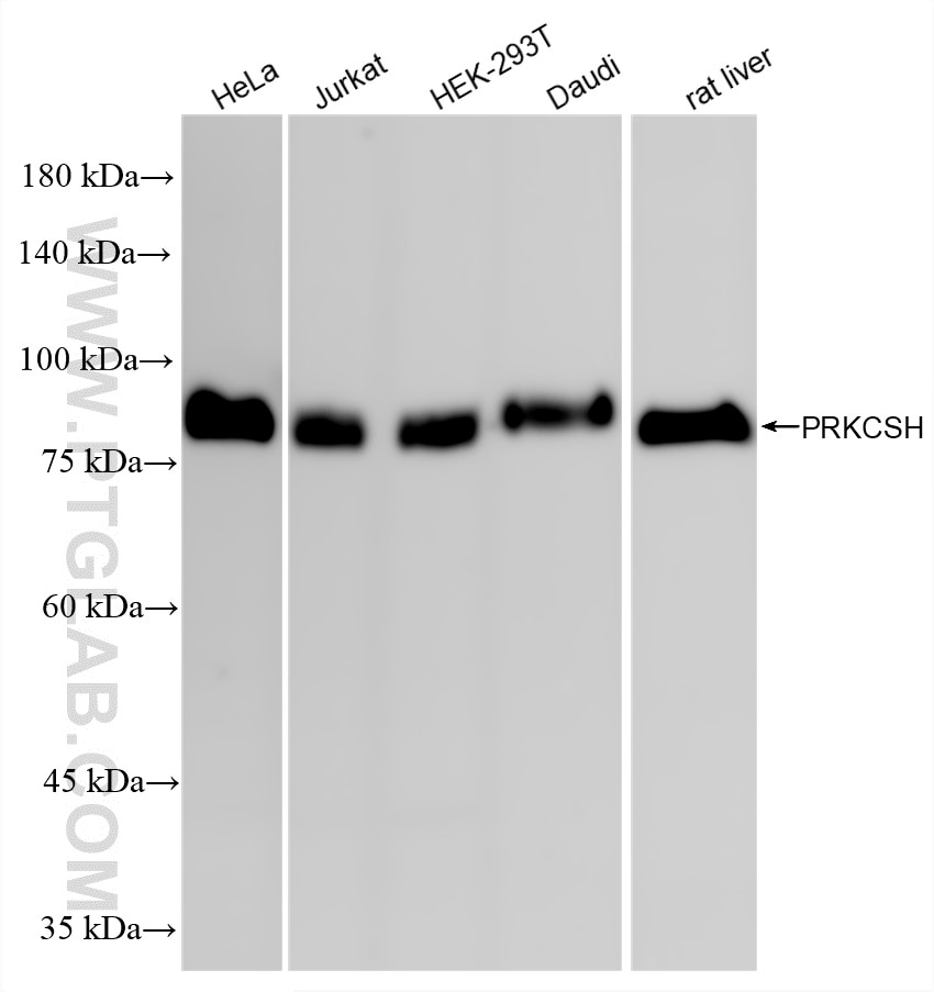 Western Blot (WB) analysis of various lysates using PRKCSH Recombinant monoclonal antibody (87004-3-RR)