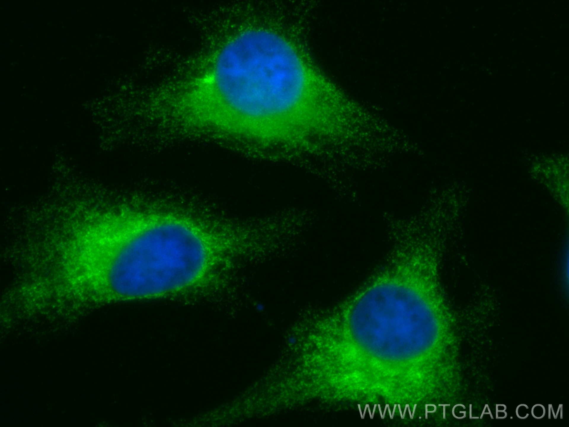 Immunofluorescence (IF) / fluorescent staining of HeLa cells using CoraLite® Plus 488-conjugated PRKCSH Polyclonal an (CL488-12148)