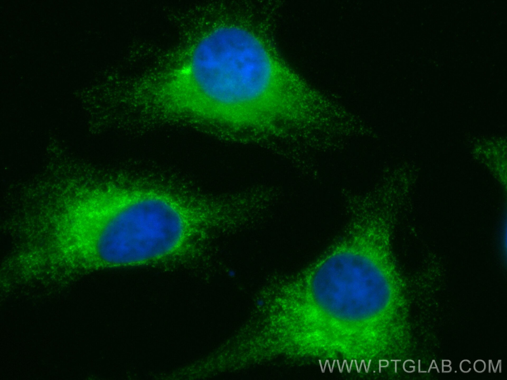 IF Staining of HeLa using CL488-12148