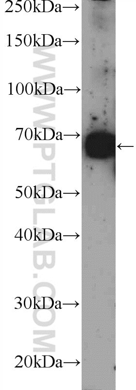 PKC Zeta Polyclonal antibody