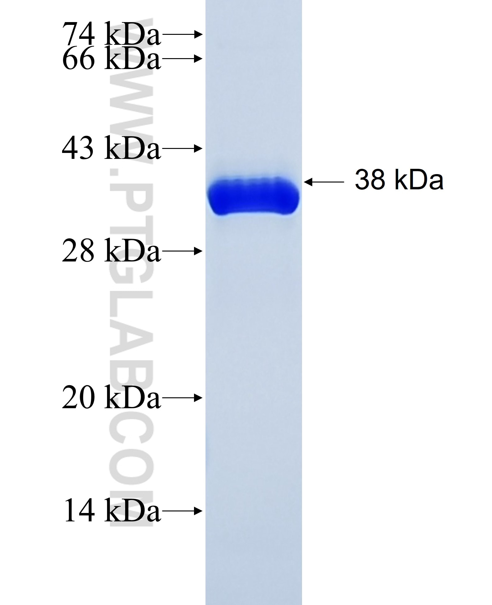 PRKCZ fusion protein Ag25391 SDS-PAGE