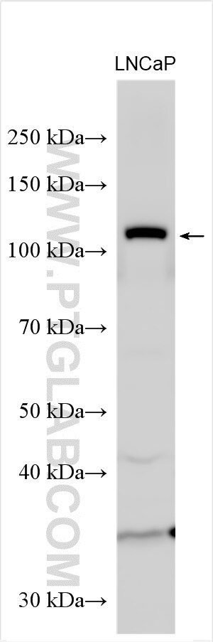 Western Blot (WB) analysis of LNCaP cells using PRKD1 Polyclonal antibody (20714-1-AP)
