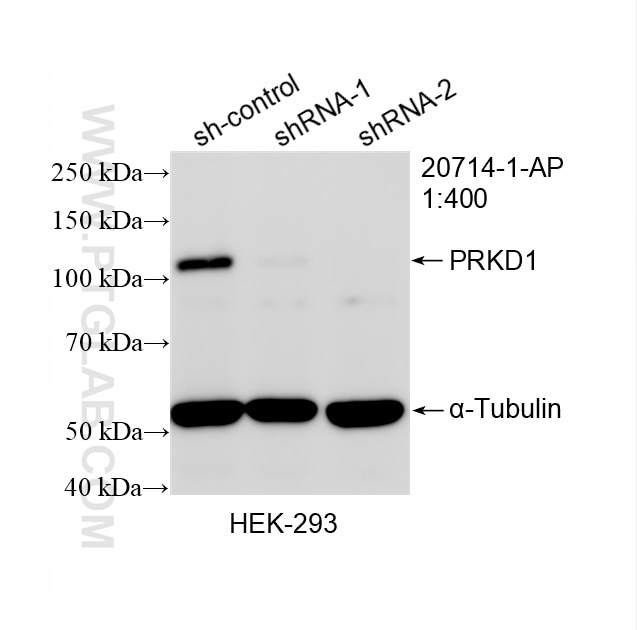 Western Blot (WB) analysis of HEK-293 cells using PRKD1 Polyclonal antibody (20714-1-AP)