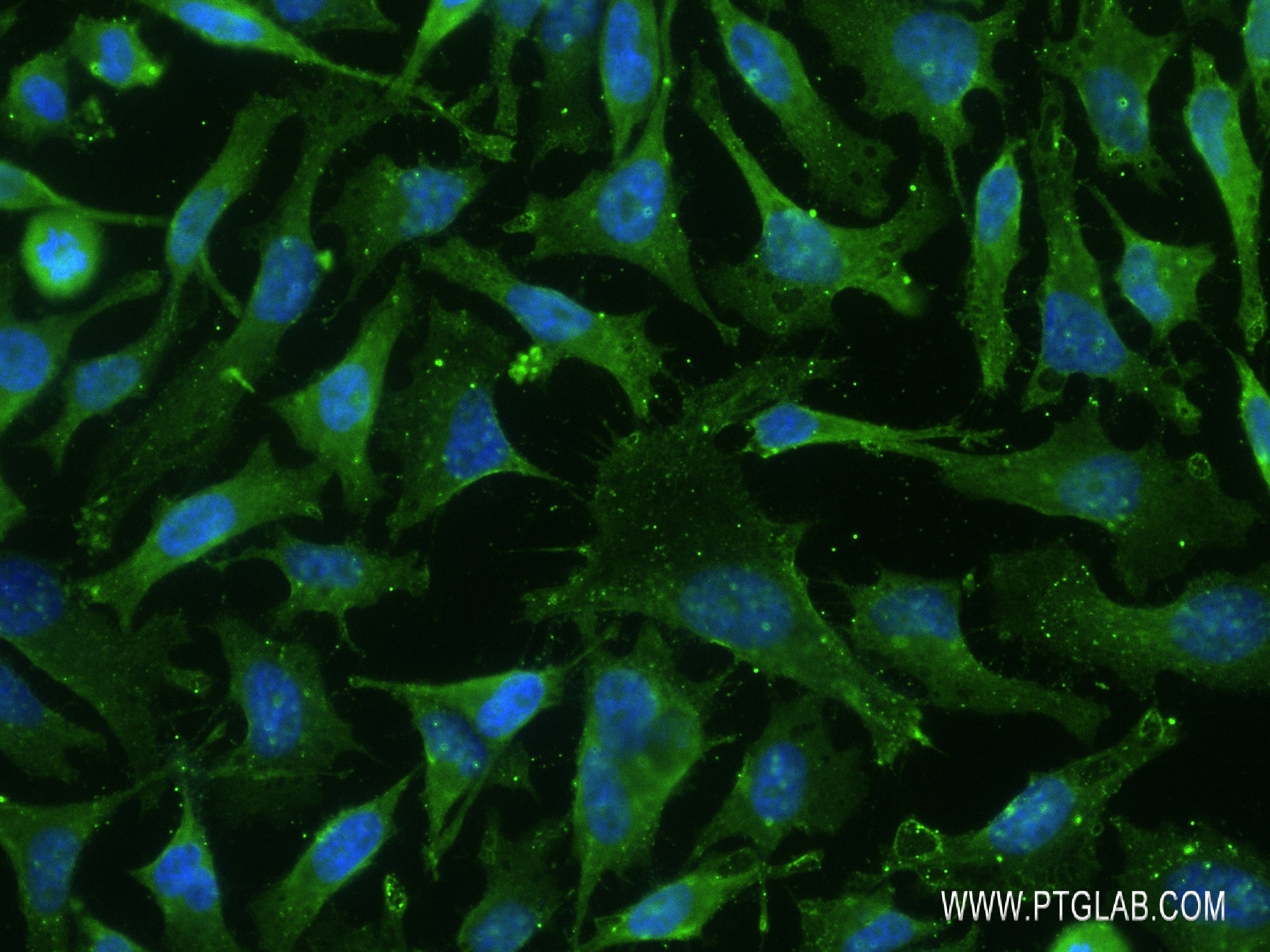 Immunofluorescence (IF) / fluorescent staining of HeLa cells using PRKD1 Recombinant antibody (83174-5-RR)