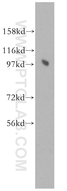 Western Blot (WB) analysis of HeLa cells using PRKD2 Polyclonal antibody (11623-1-AP)