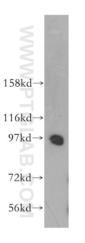 Western Blot (WB) analysis of human brain tissue using PRKD2 Polyclonal antibody (11623-1-AP)