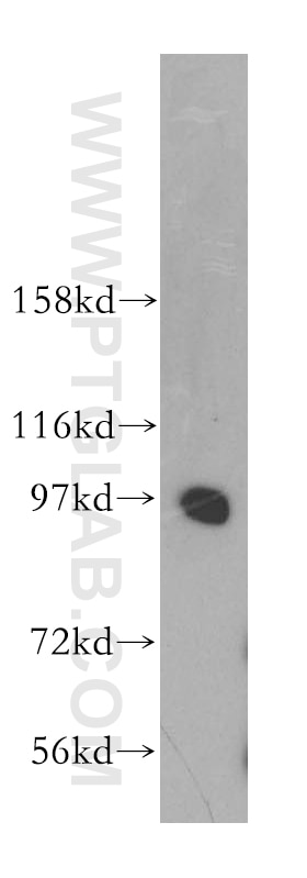 WB analysis of human brain using 11623-1-AP