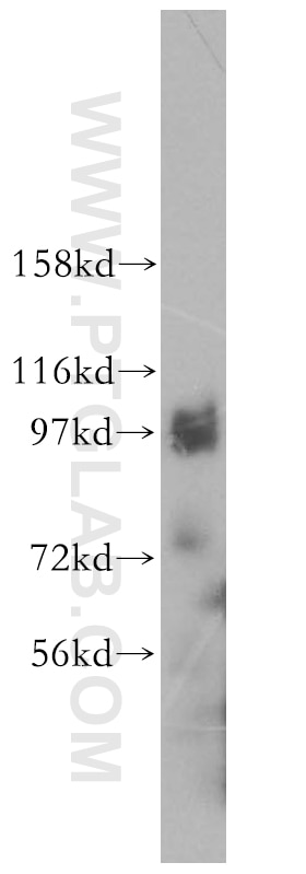 Western Blot (WB) analysis of human kidney tissue using PRKD2 Polyclonal antibody (11623-1-AP)