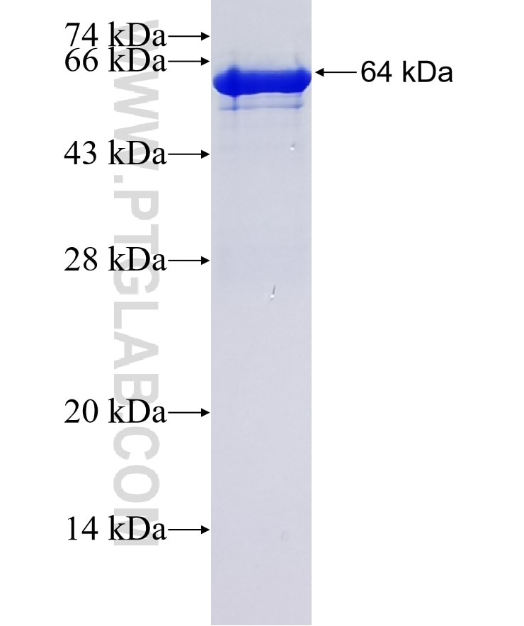 PRKD2 fusion protein Ag2192 SDS-PAGE