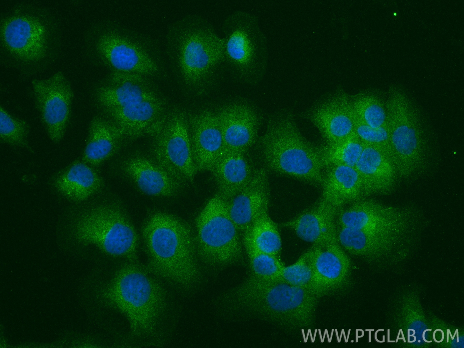 IF Staining of DU 145 using 12785-1-AP Immunofluorescence (IF) / fluorescent staining of DU 145 cells using PRKD3 Polyclonal antibody (12785-1-AP)