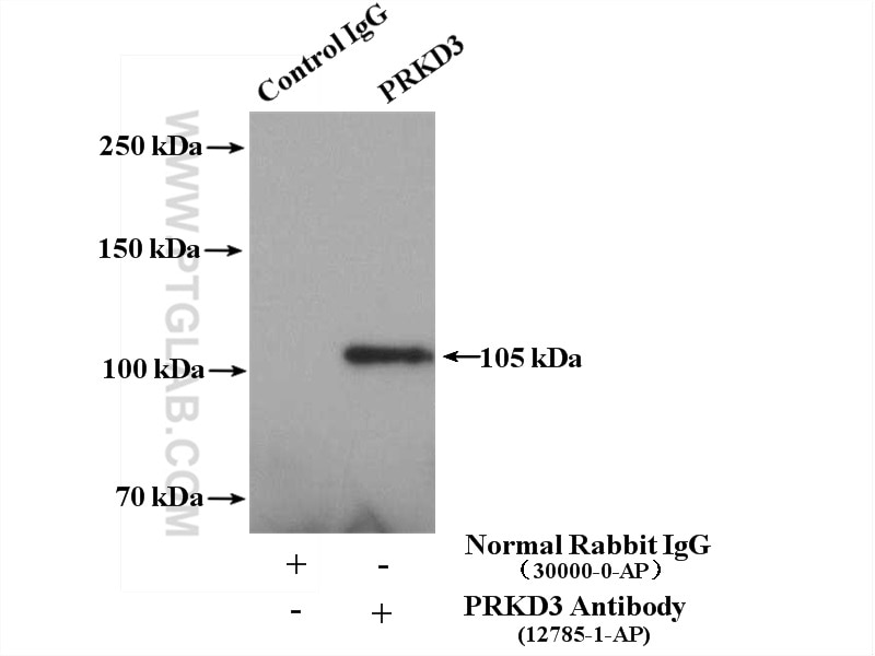Immunoprecipitation (IP) experiment of HEK-293 cells using PRKD3 Polyclonal antibody (12785-1-AP)