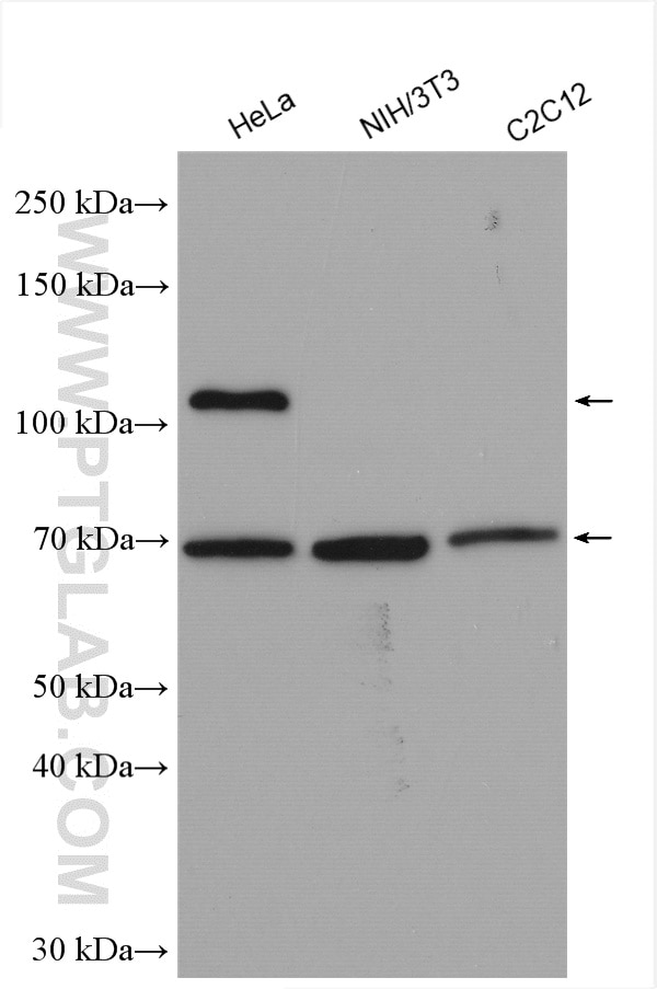 Western Blot (WB) analysis of various lysates using PRKD3 Polyclonal antibody (12785-1-AP)
