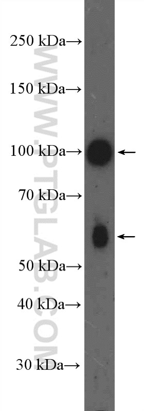 Western Blot (WB) analysis of DU 145 cells using PRKD3 Polyclonal antibody (12785-1-AP)