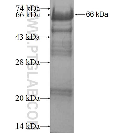 PRKD3 fusion protein Ag3499 SDS-PAGE