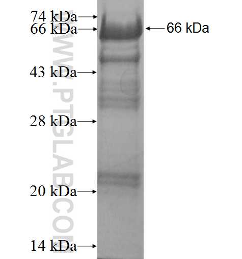 PRKD3 fusion protein Ag3499 SDS-PAGE