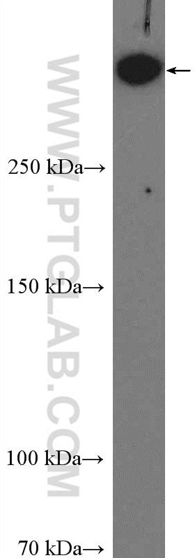 WB analysis of MCF-7 using 19983-1-AP