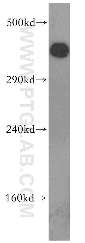 Western Blot (WB) analysis of HeLa cells using DNA-PKcs Polyclonal antibody (19983-1-AP)