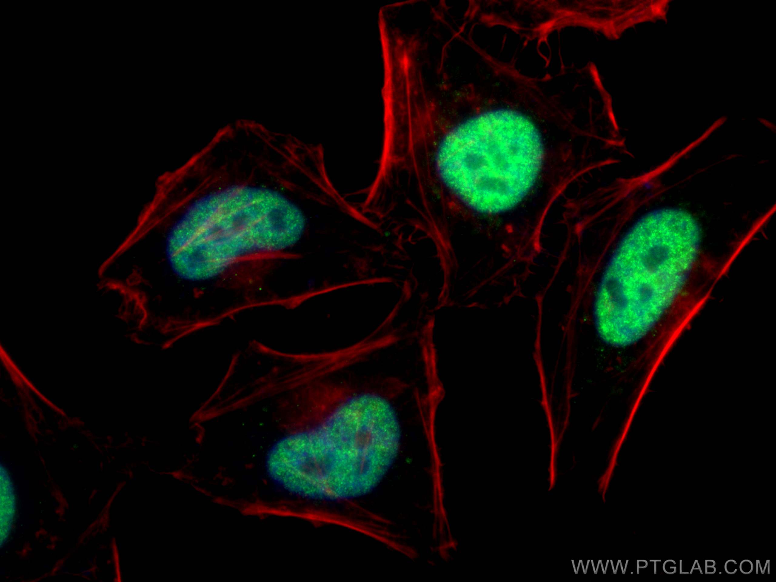 Immunofluorescence (IF) / fluorescent staining of HeLa cells using DNA-PKcs Polyclonal antibody (28534-1-AP)