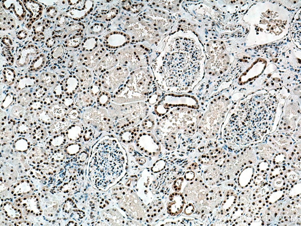 Immunohistochemistry (IHC) staining of human kidney tissue using DNA-PKcs Polyclonal antibody (28534-1-AP)