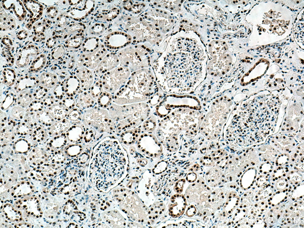 Immunohistochemistry (IHC) staining of human kidney tissue using DNA-PKcs Polyclonal antibody (28534-1-AP)