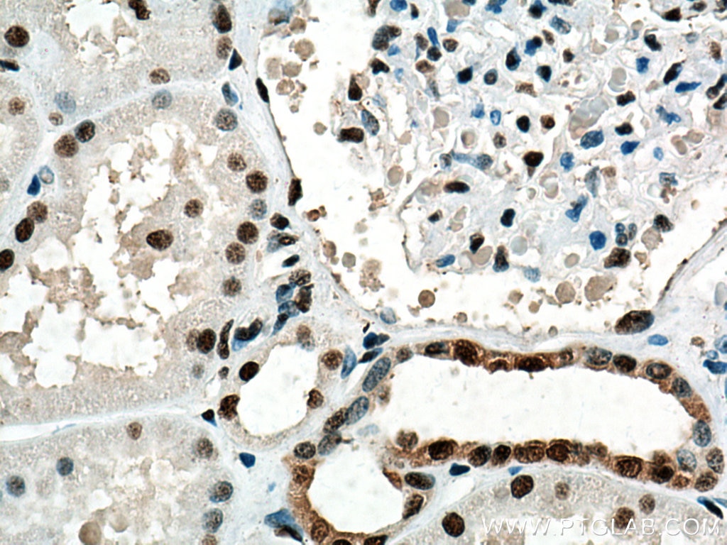 Immunohistochemistry (IHC) staining of human kidney tissue using DNA-PKcs Polyclonal antibody (28534-1-AP)