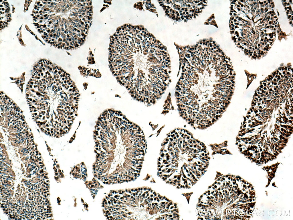 Immunohistochemistry (IHC) staining of mouse testis tissue using DNA-PKcs Polyclonal antibody (28534-1-AP)