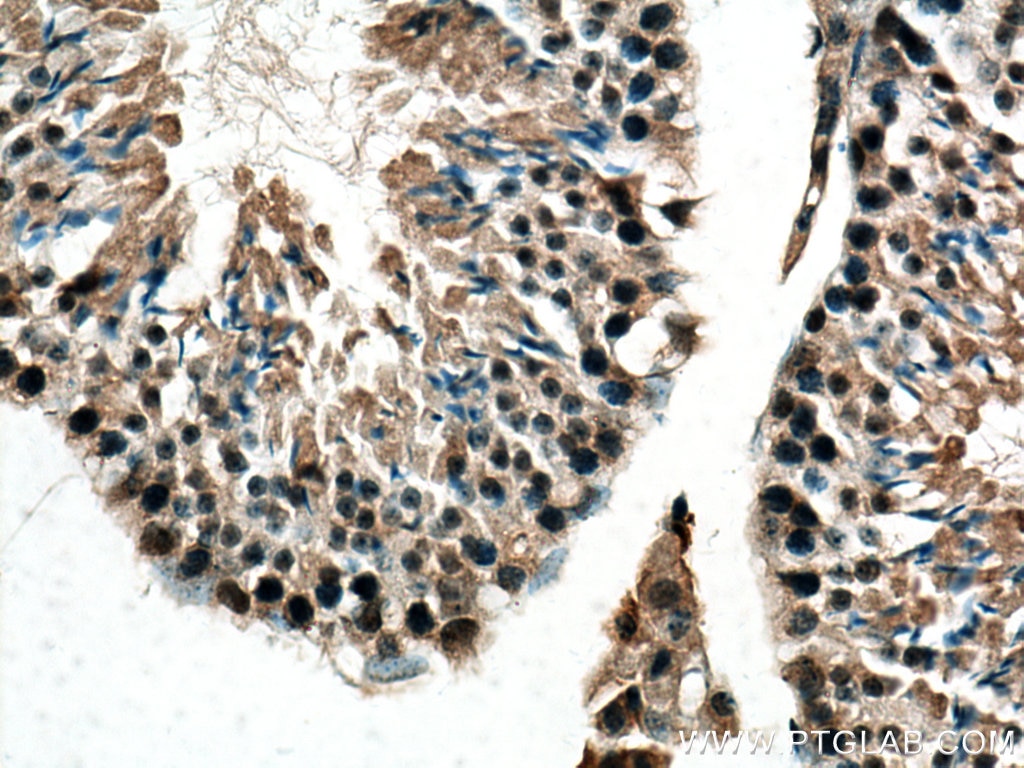 Immunohistochemistry (IHC) staining of mouse testis tissue using DNA-PKcs Polyclonal antibody (28534-1-AP)